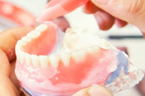 التركيبات وطواقم الاسنان