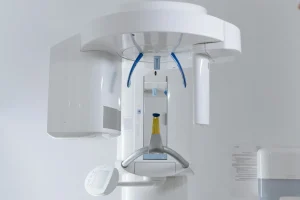 All-on-4 implant: tam çene 4 implant ile — Veskedent Blog