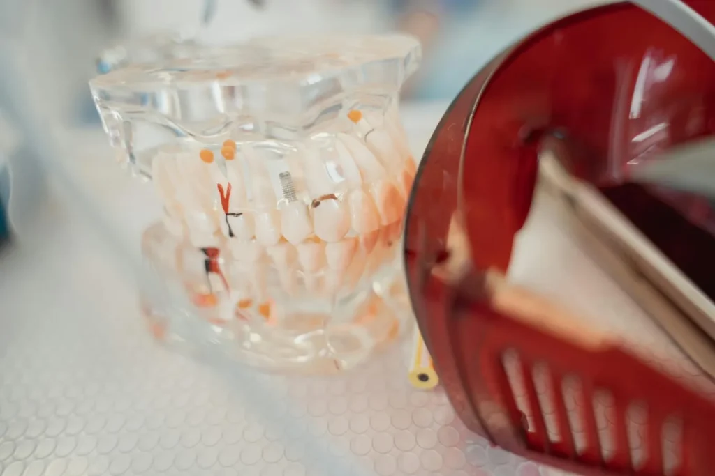 باقة بداية Invisalign